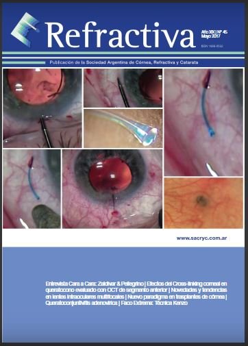 Tapa de Refractiva N.º 45