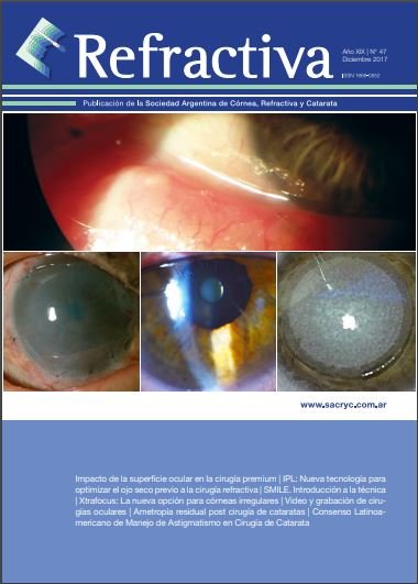 Tapa de Refractiva N.º 47