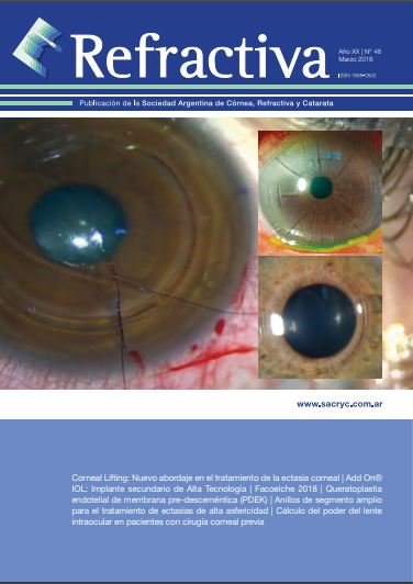 Tapa de Refractiva N.º 48