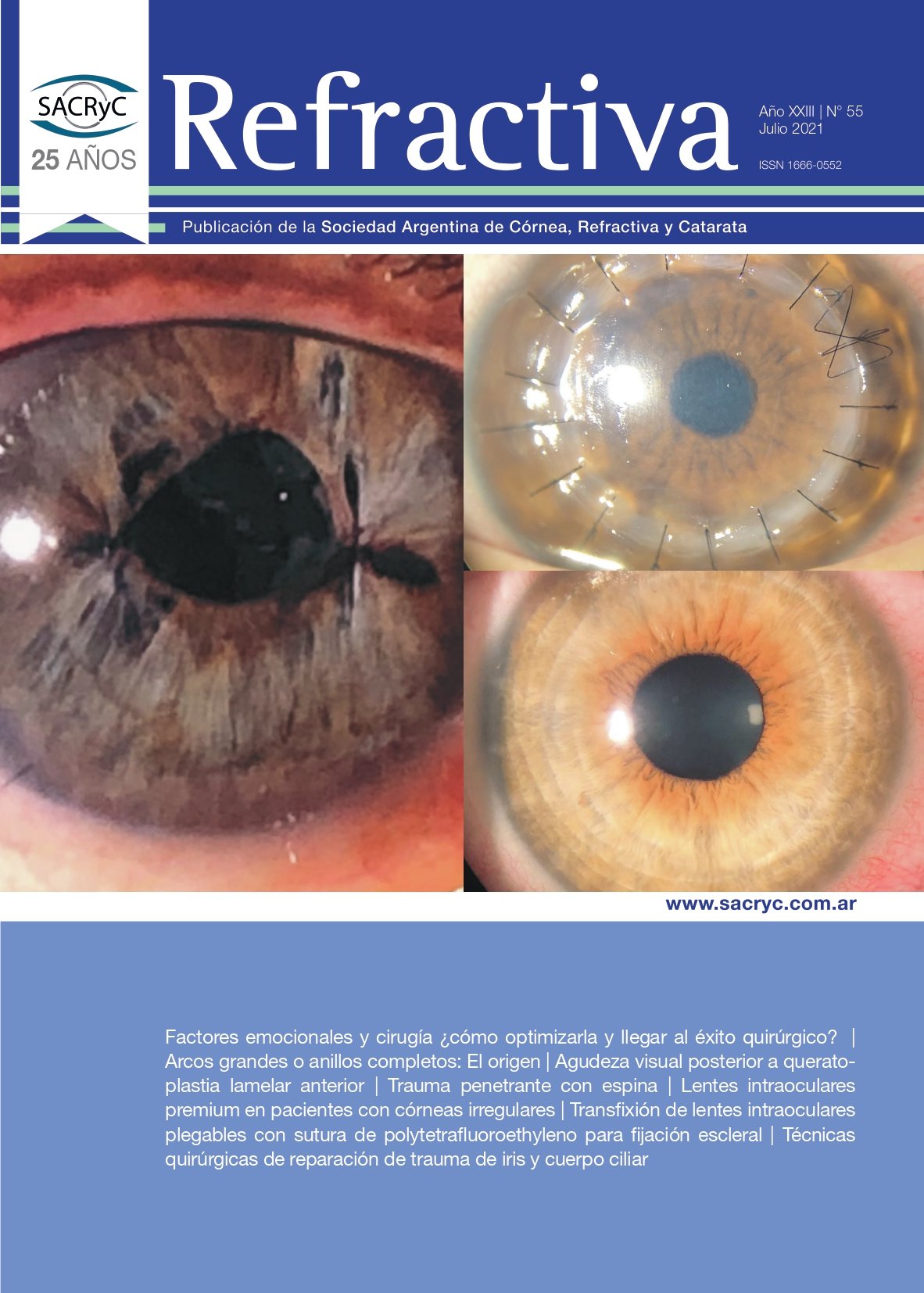 Tapa de Refractiva N.º 55