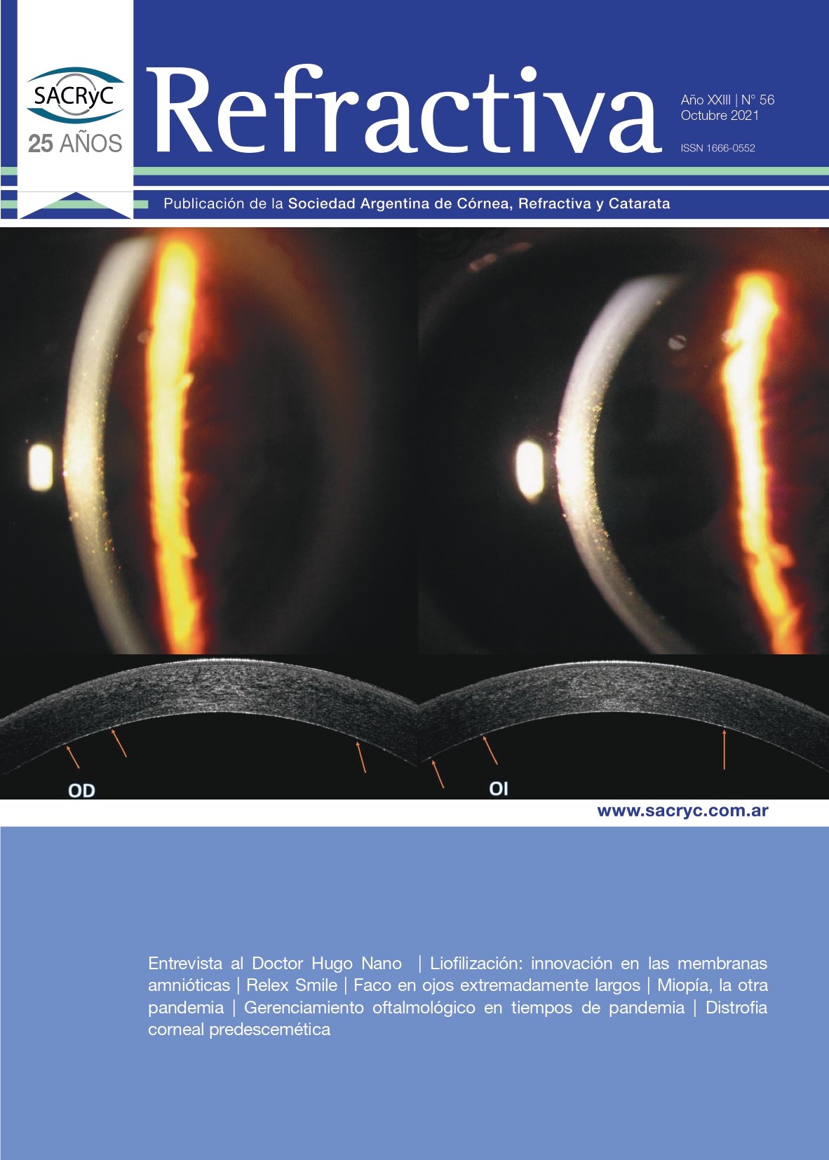 Tapa de Refractiva N.º 56