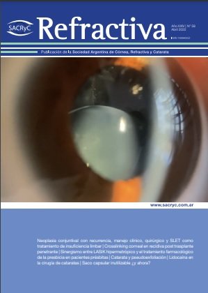 Tapa de Refractiva N.º 58