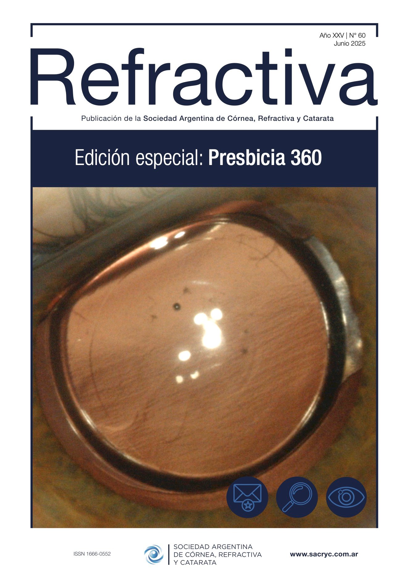 Tapa de Refractiva N.º 60
